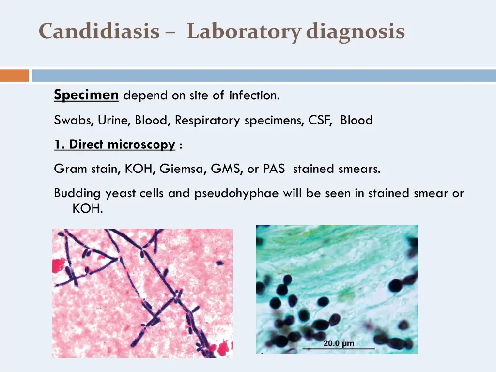 candidiasis laboratory diagnosis