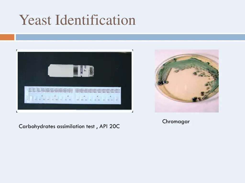 yeast identification
