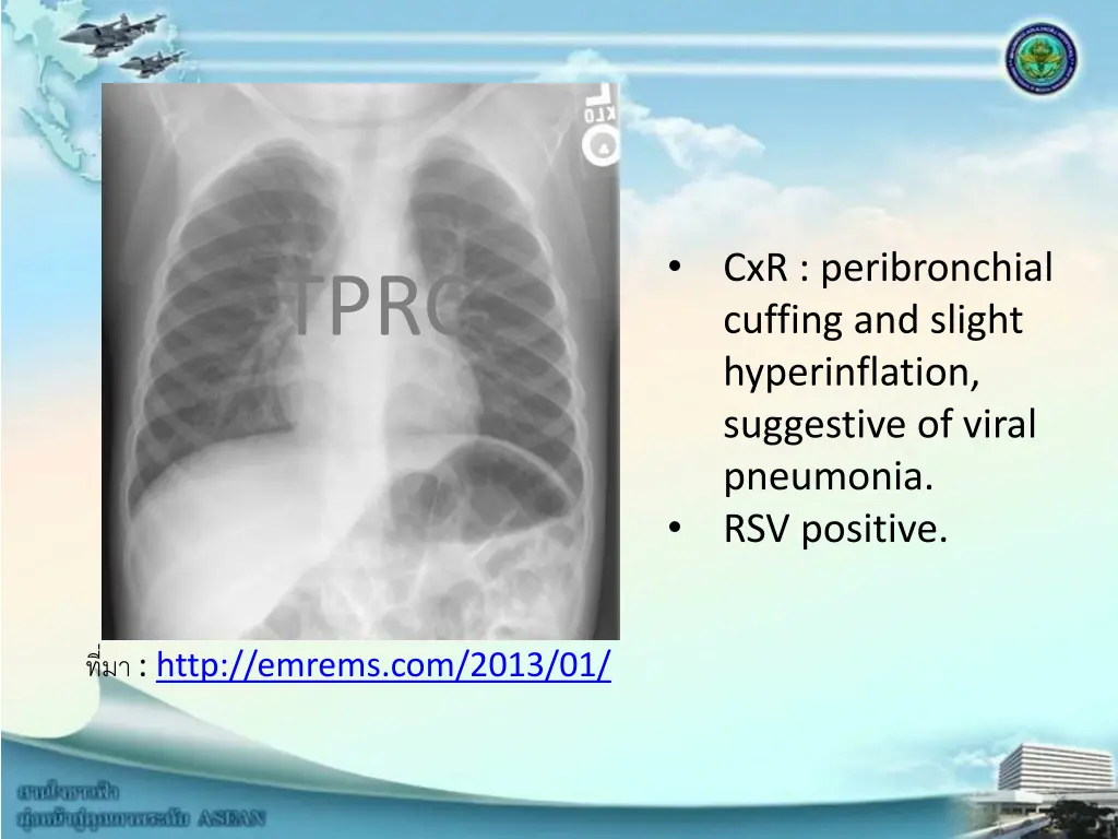 slide3