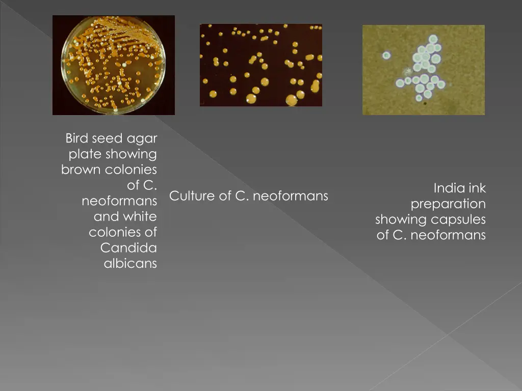 bird seed agar plate showing brown colonies