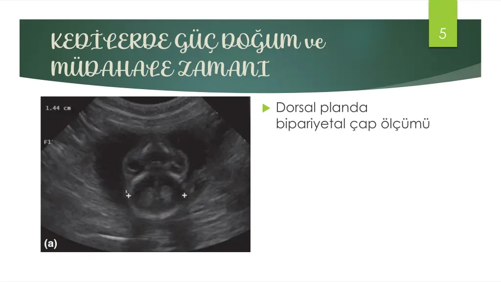 slide5