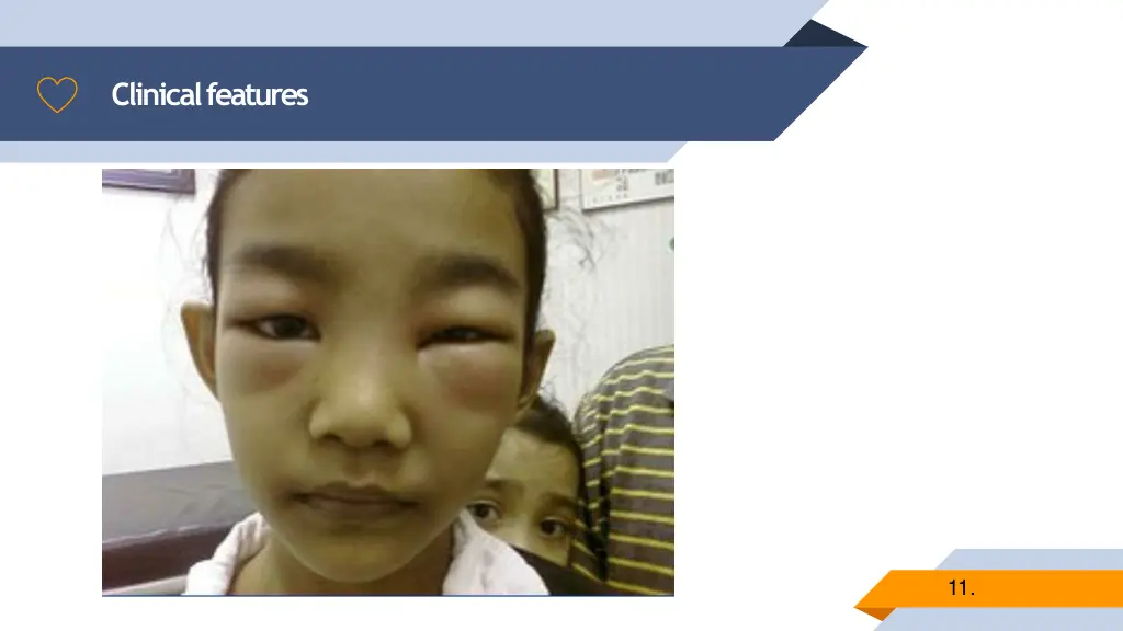 clinical features 1