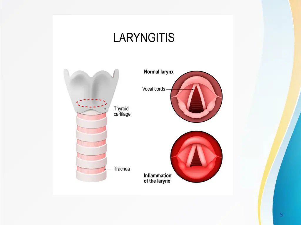 slide5