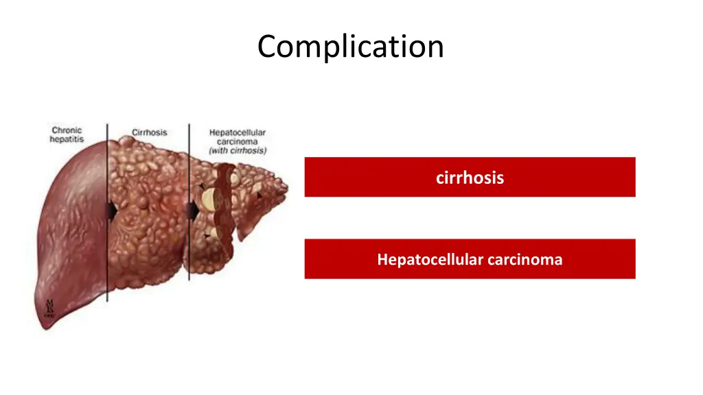 complication