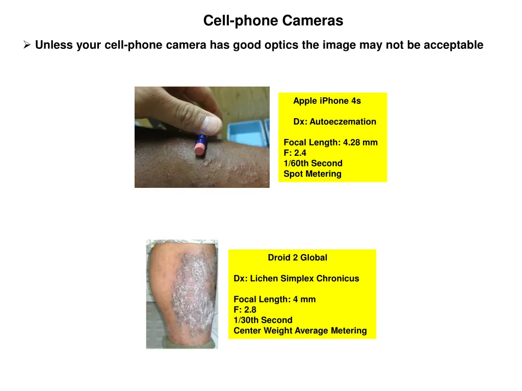 cell phone cameras
