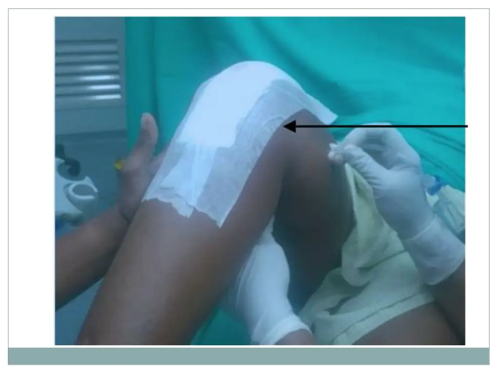 slide7