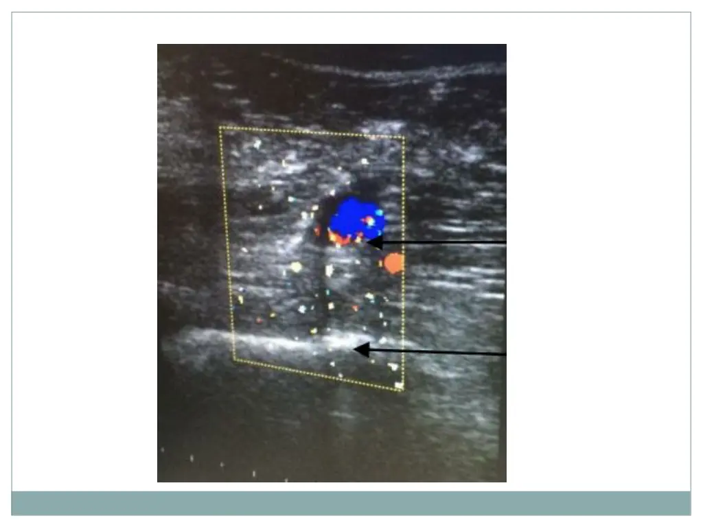 slide9