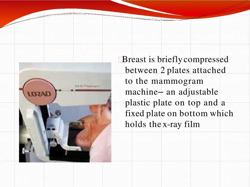 breast is briefly compressed between 2 plates