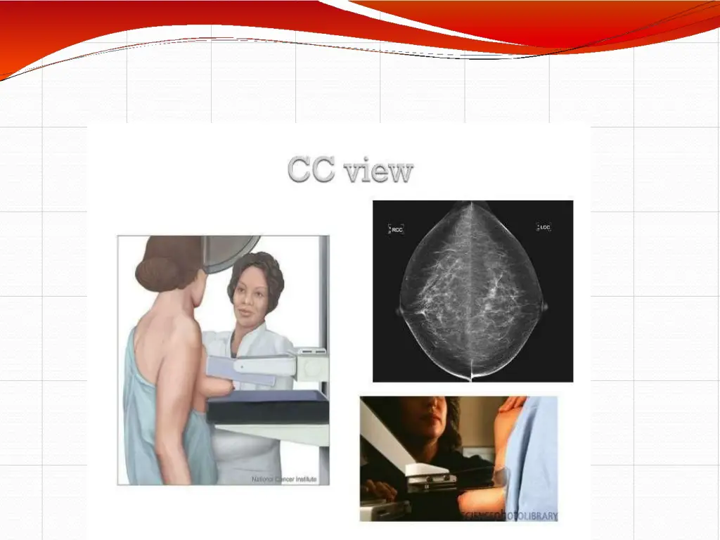 slide17