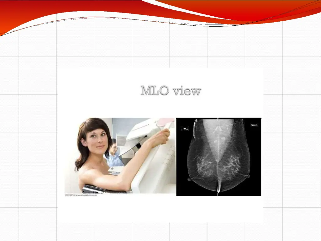 slide18