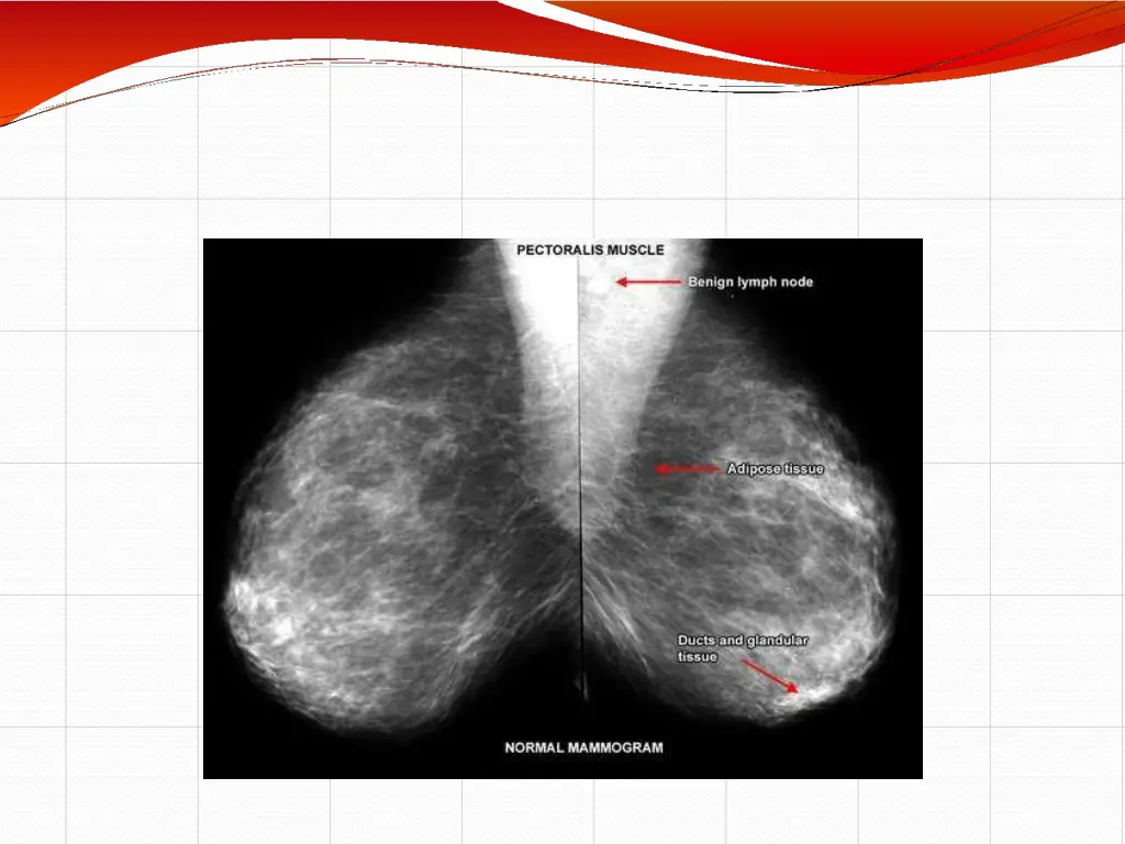 slide19