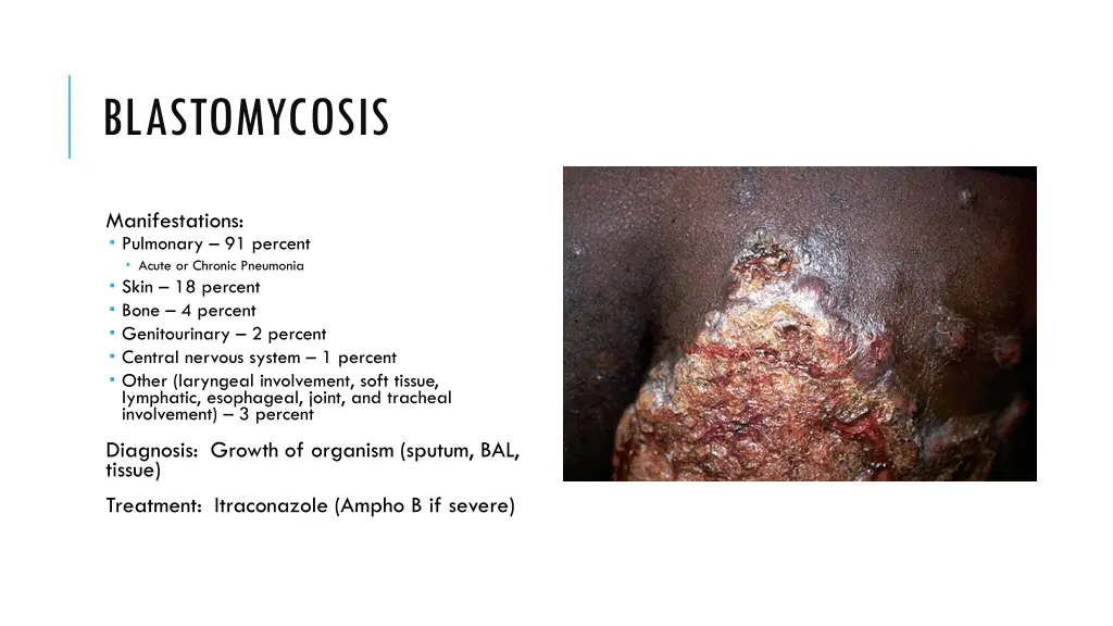 blastomycosis 1