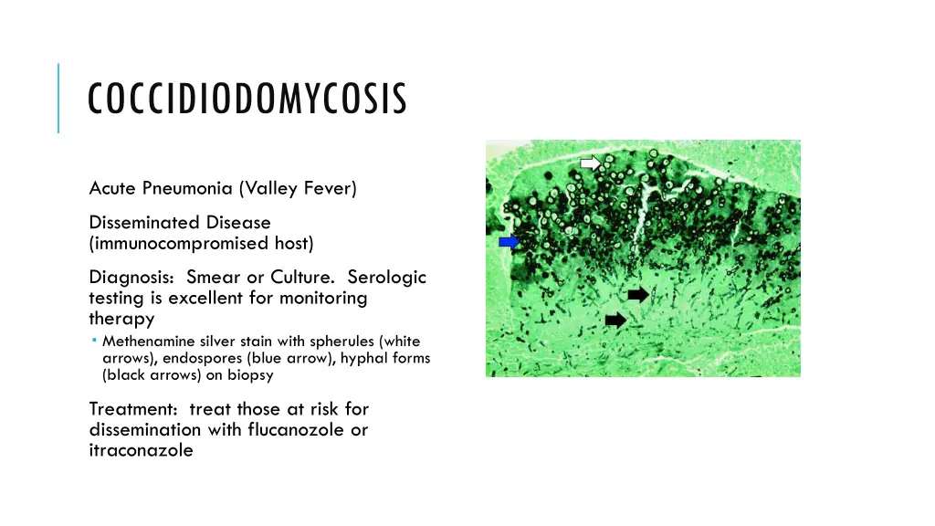 coccidiodomycosis 1