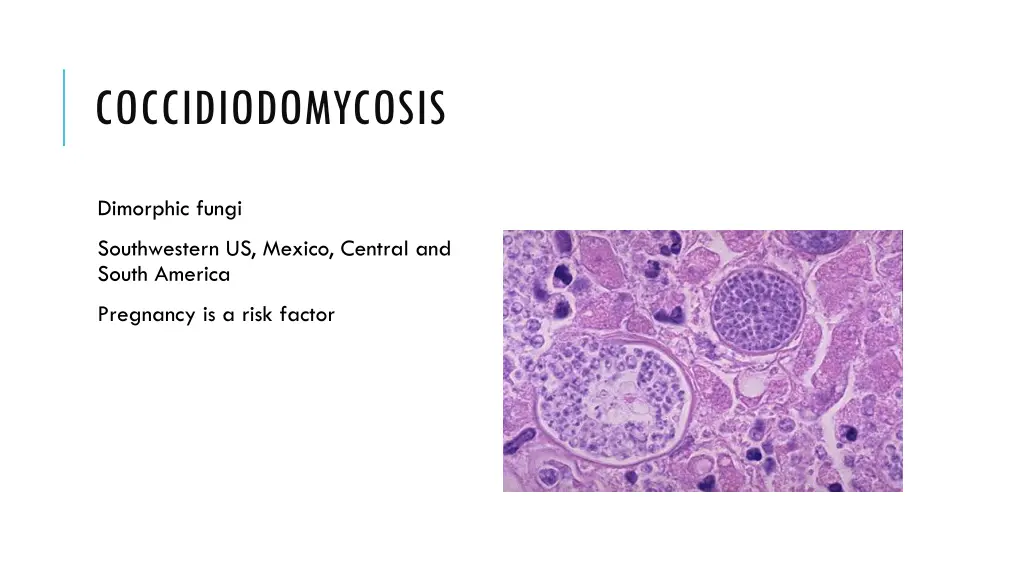 coccidiodomycosis