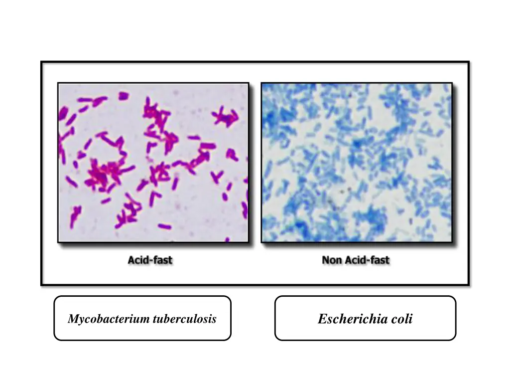 escherichia coli