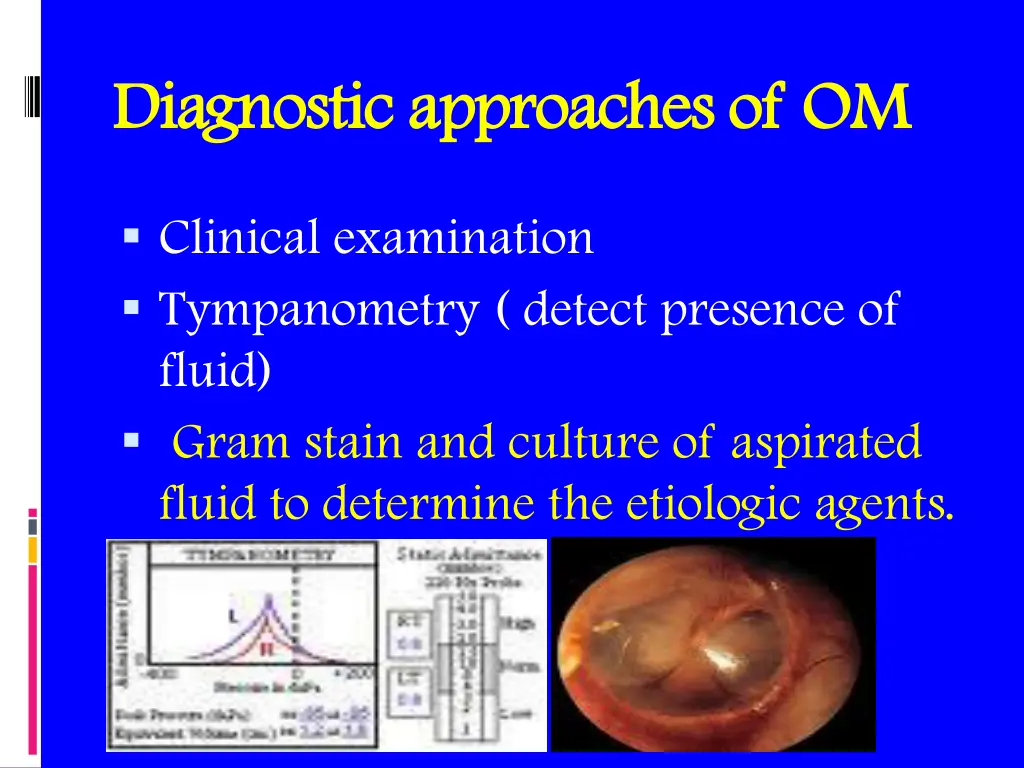 diagnostic approaches of om diagnostic approaches