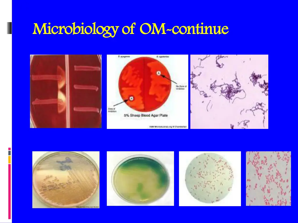microbiology of om microbiology of om continue