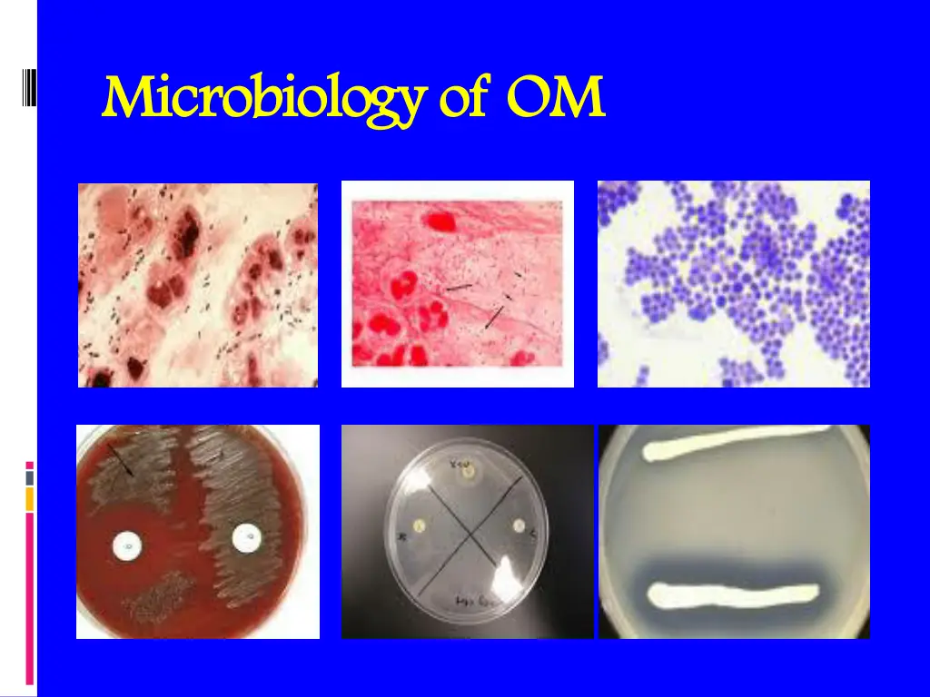 microbiology of om microbiology of om