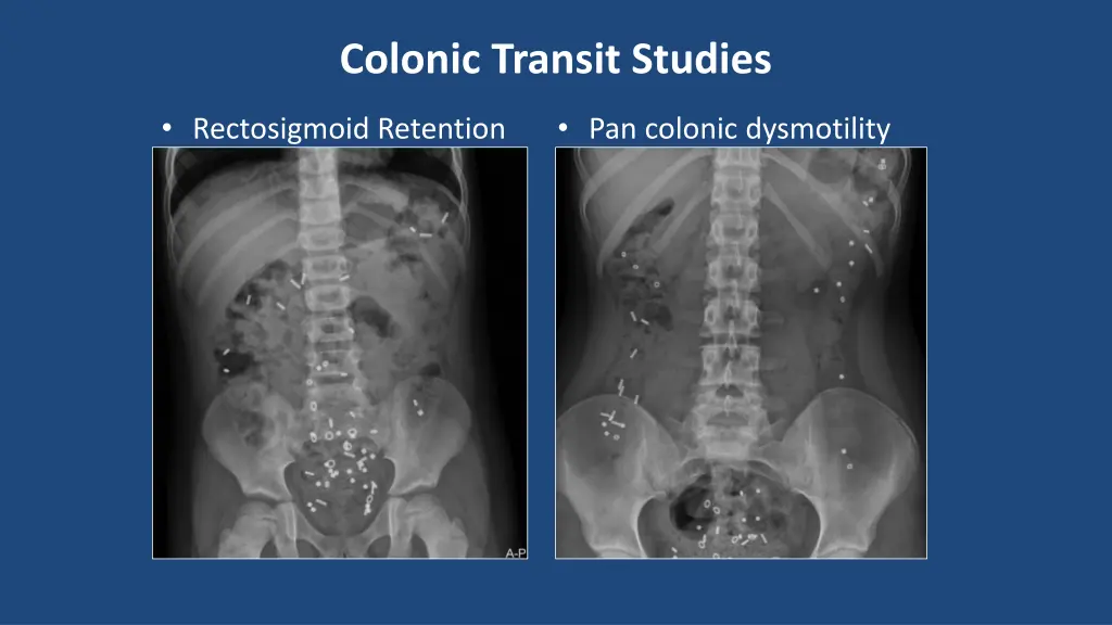 colonic transit studies 1