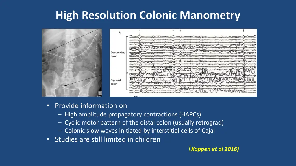 high resolution colonic manometry
