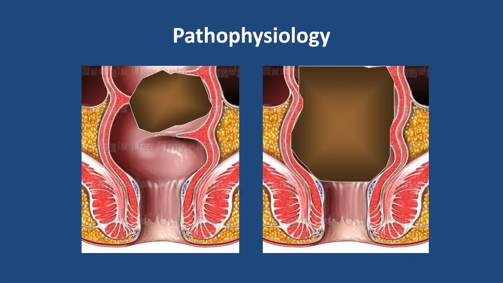 pathophysiology