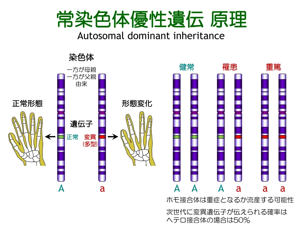 autosomal dominant inheritance