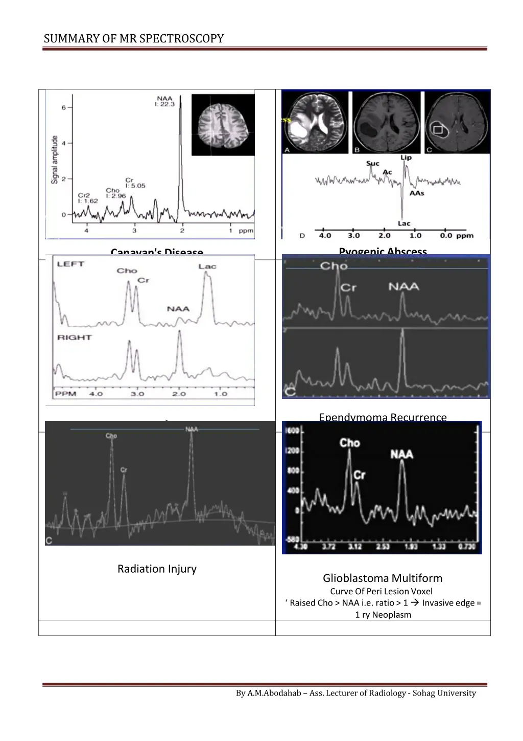 summary of mrspectroscopy 4