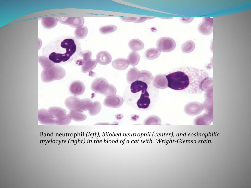 band neutrophil left bilobed neutrophil center