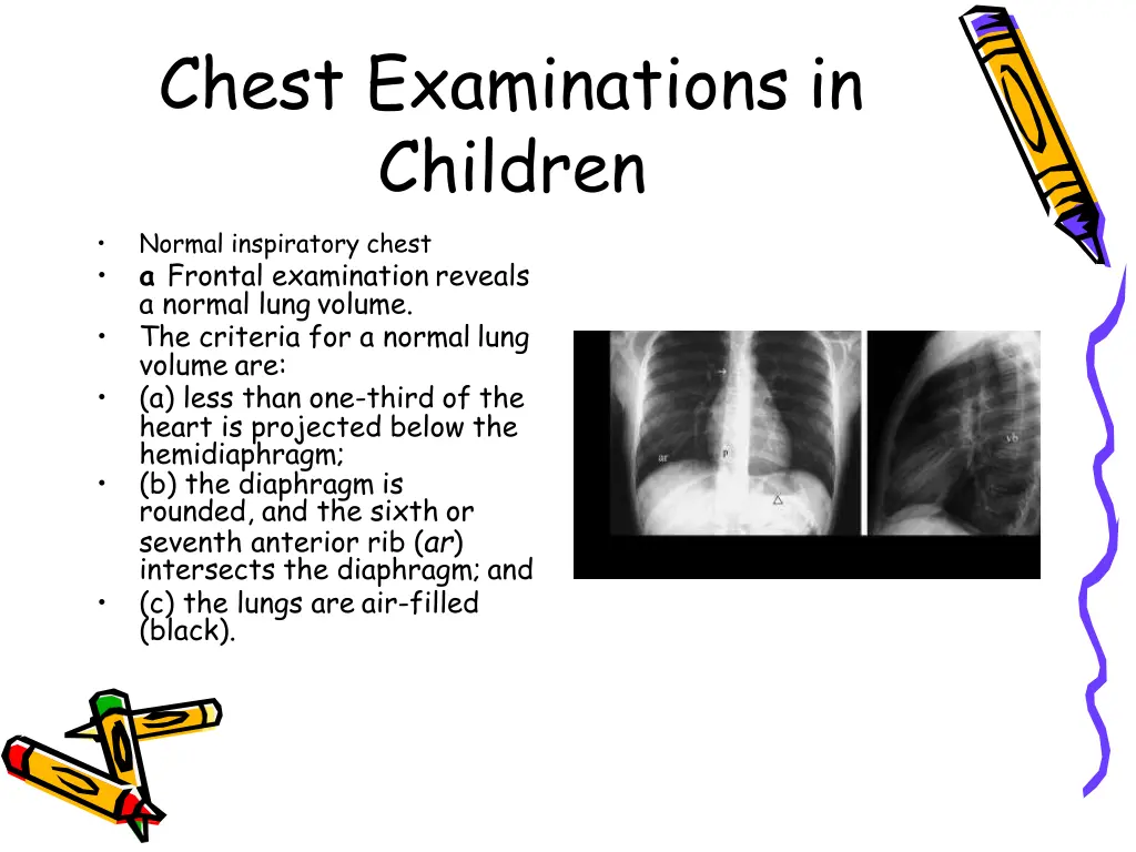 chest examinations in children