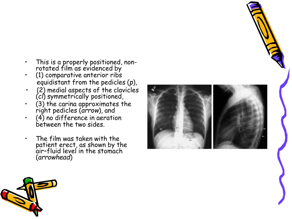 slide37