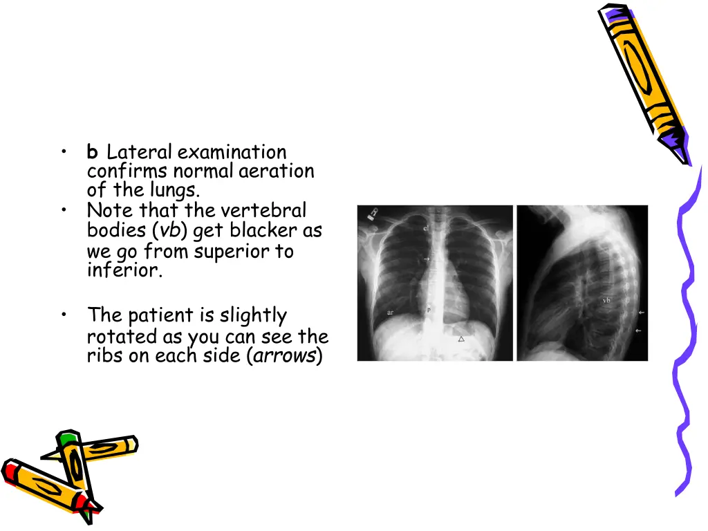 slide38