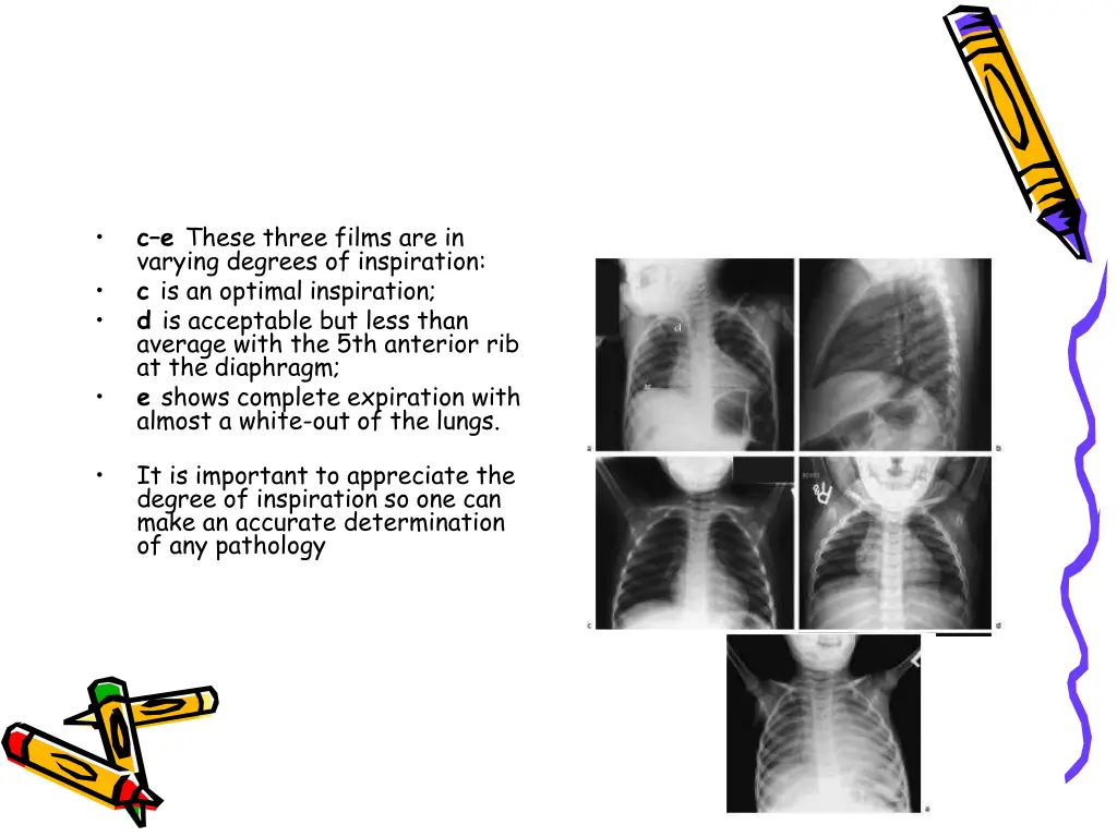 slide46