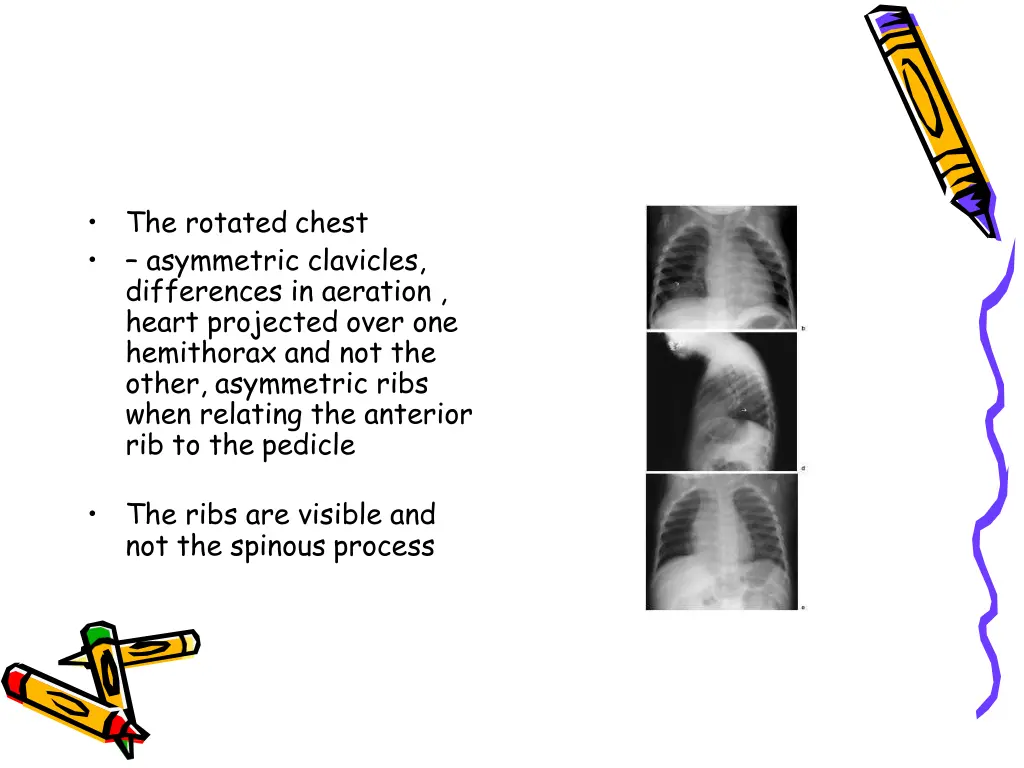 slide47