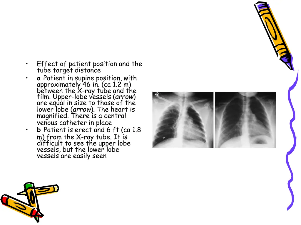 slide50