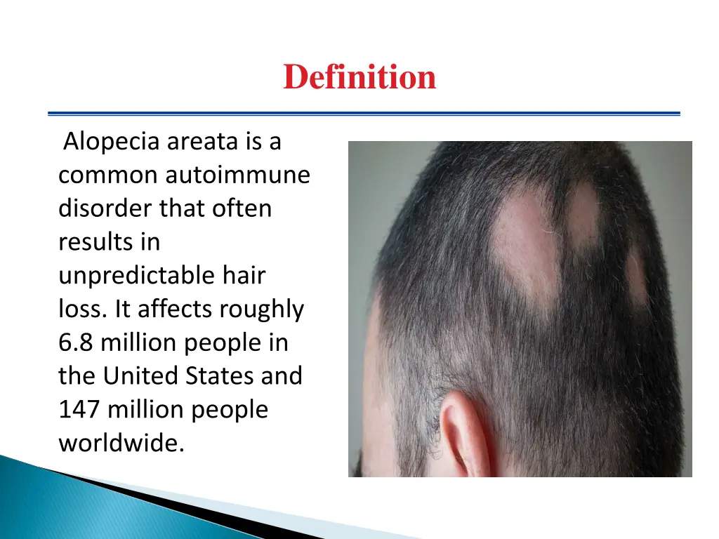 definition
