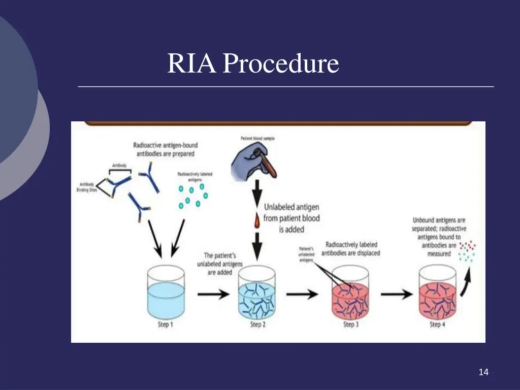 ria procedure