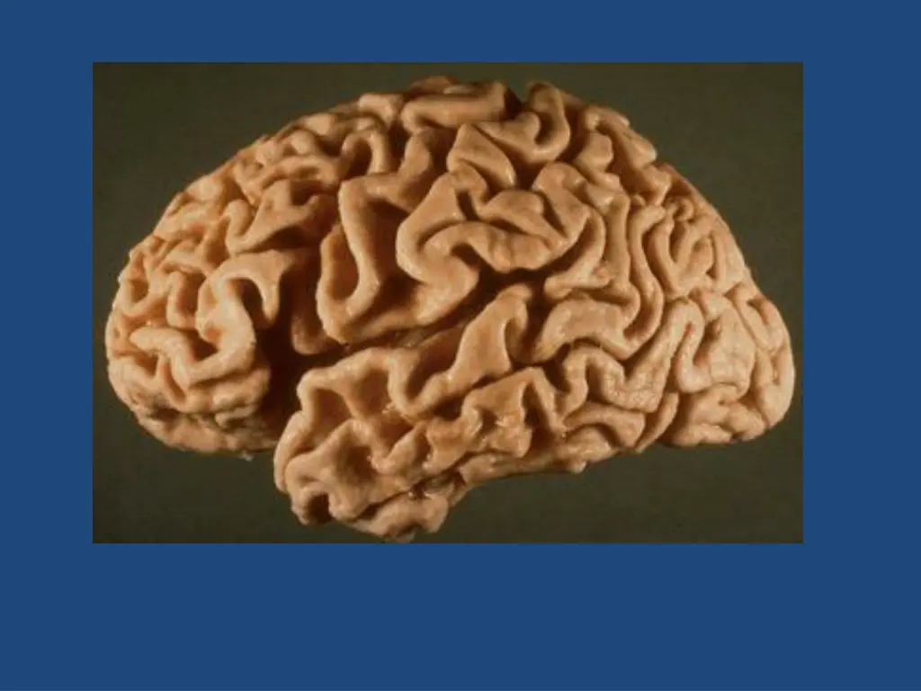 slide25