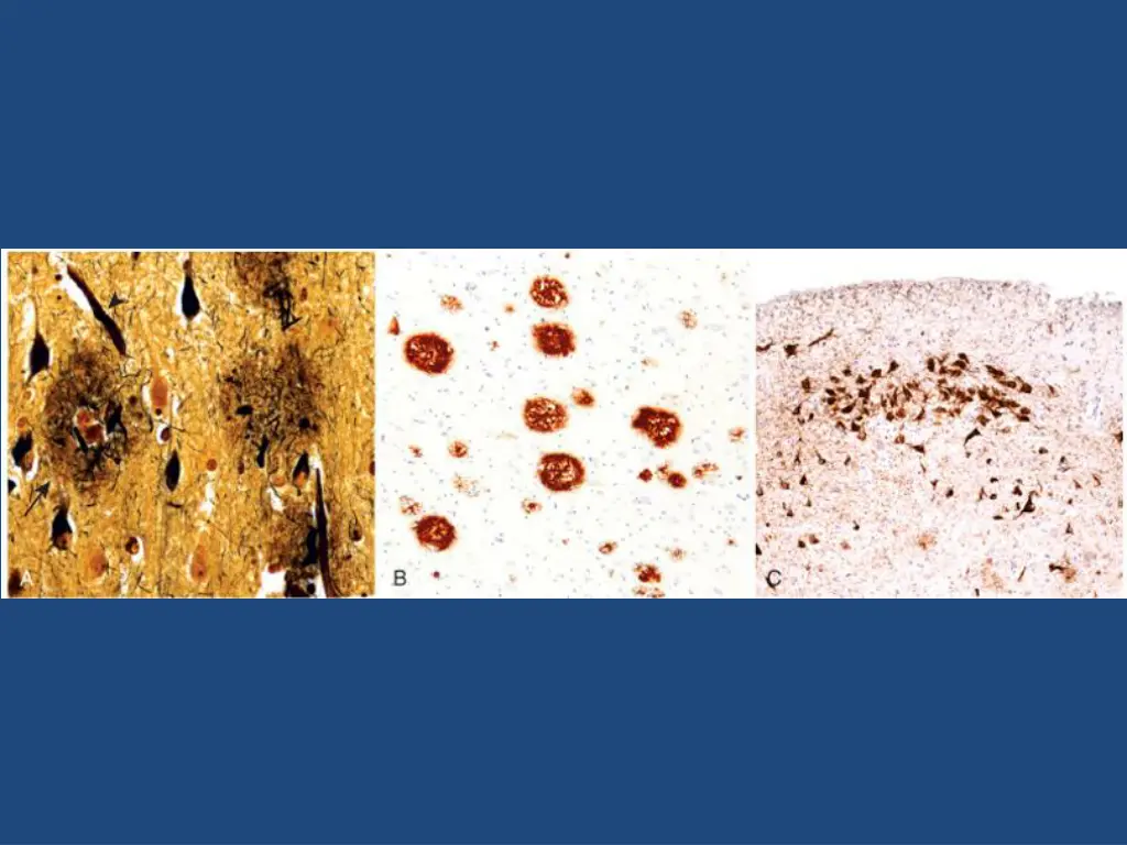 slide26