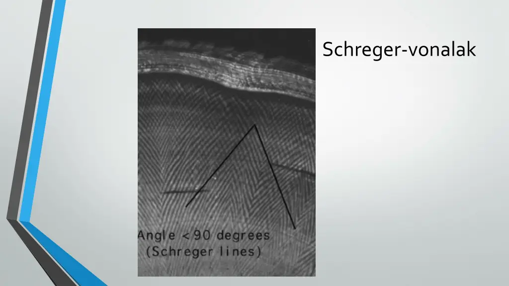 schreger vonalak