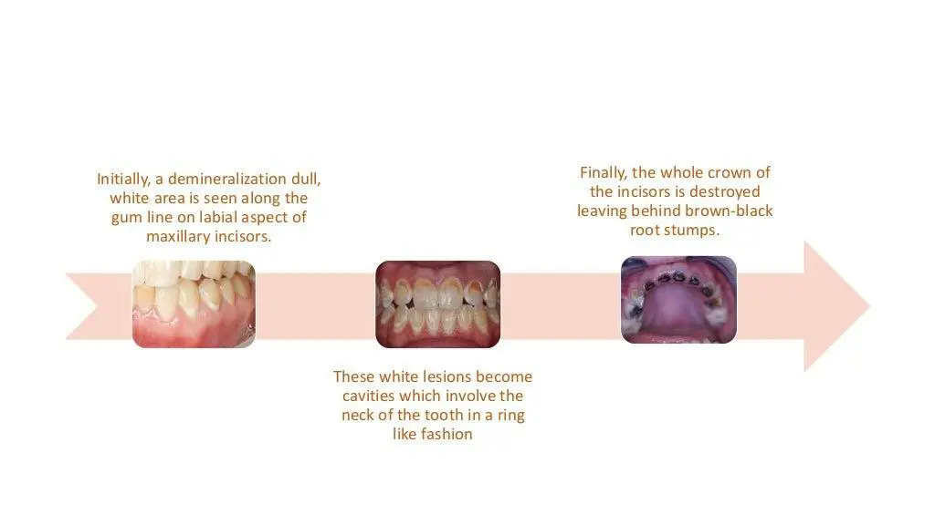 slide14