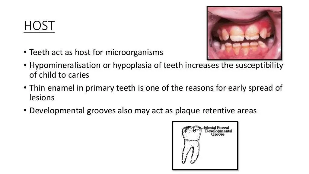 slide19