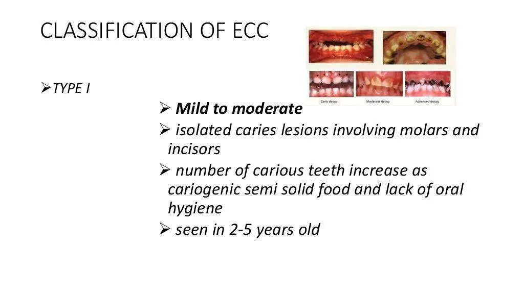 slide7