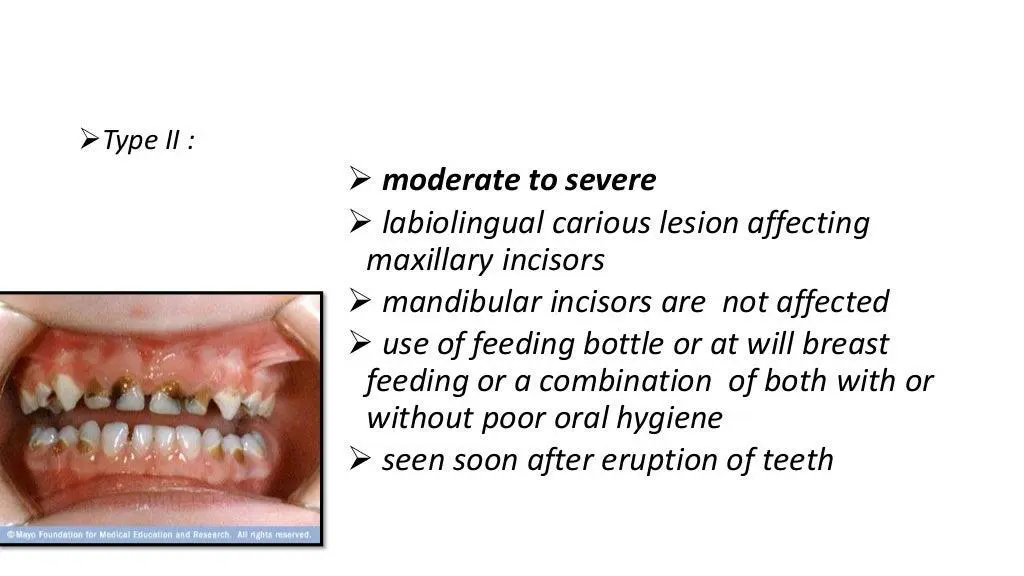 slide8