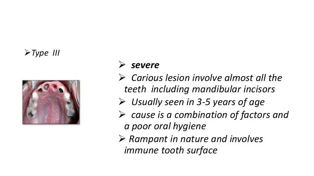 slide9