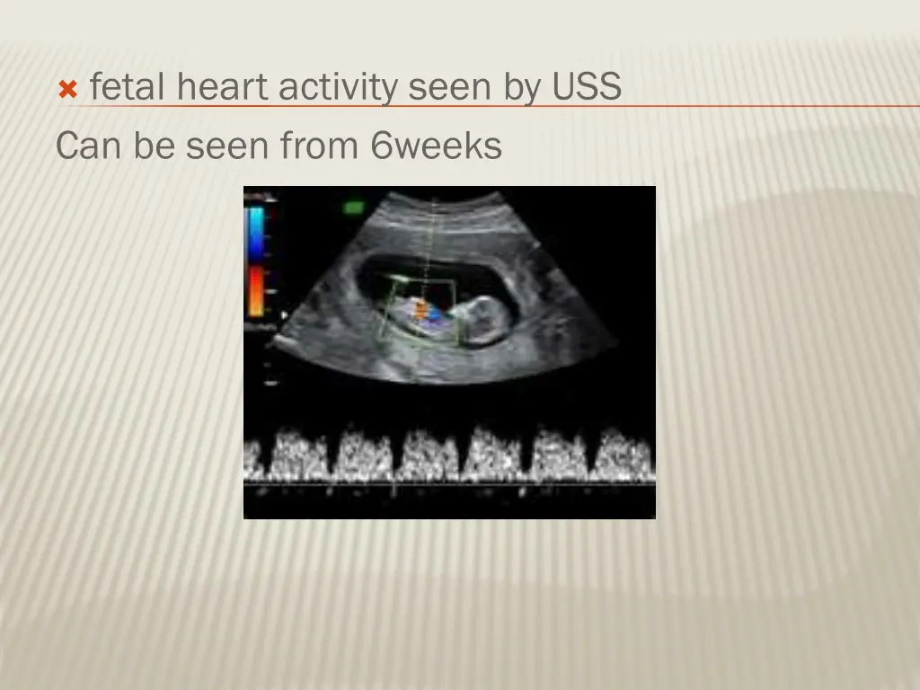 fetal heart activity seen by uss can be seen from