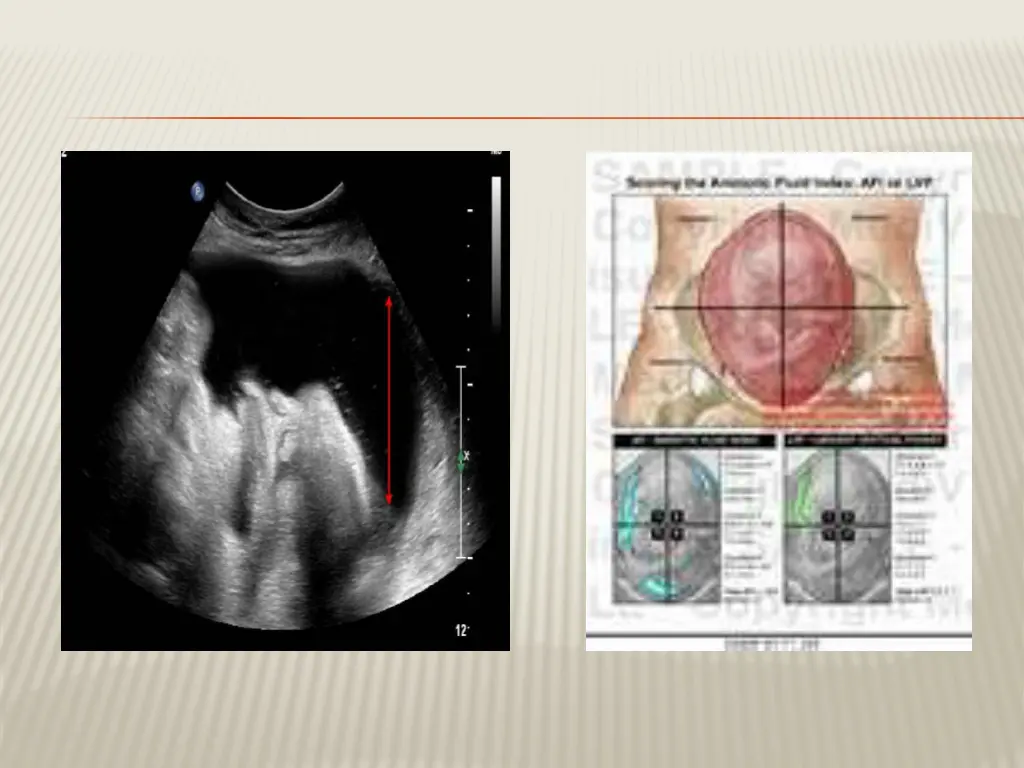 slide17