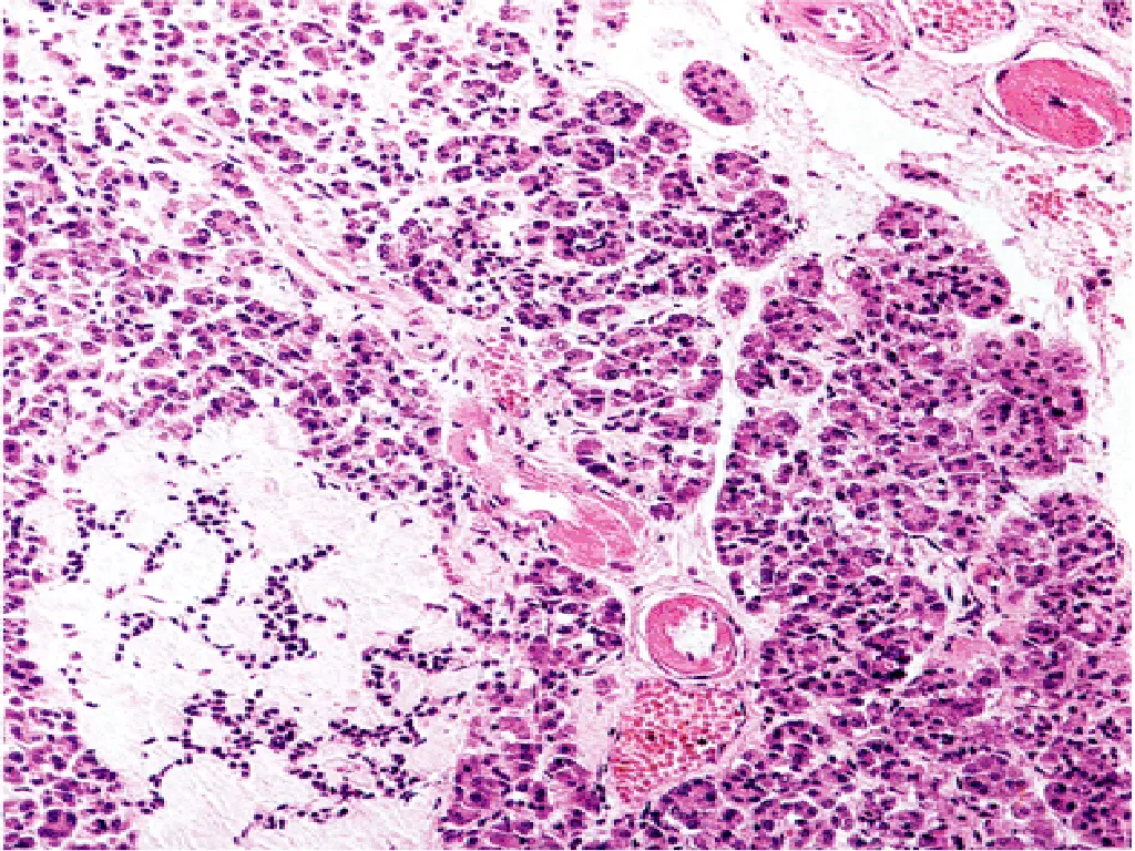 slide35