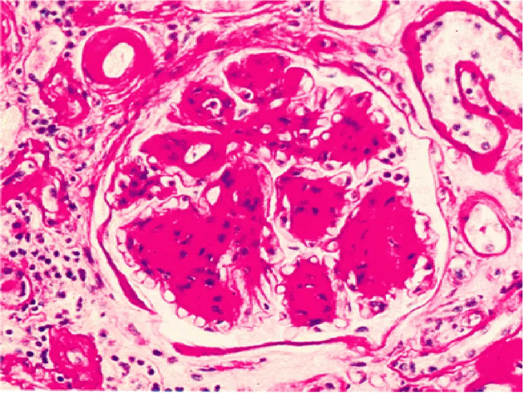 slide41