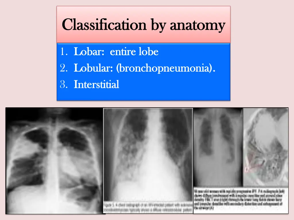 classification by anatomy classification