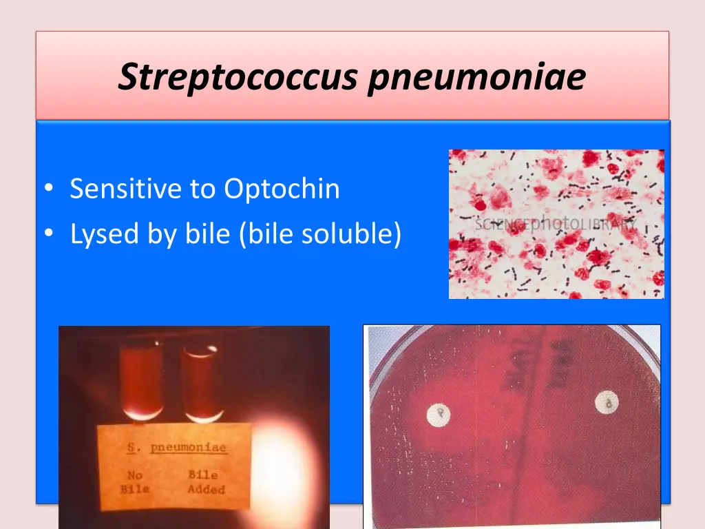 streptococcus pneumoniae 2